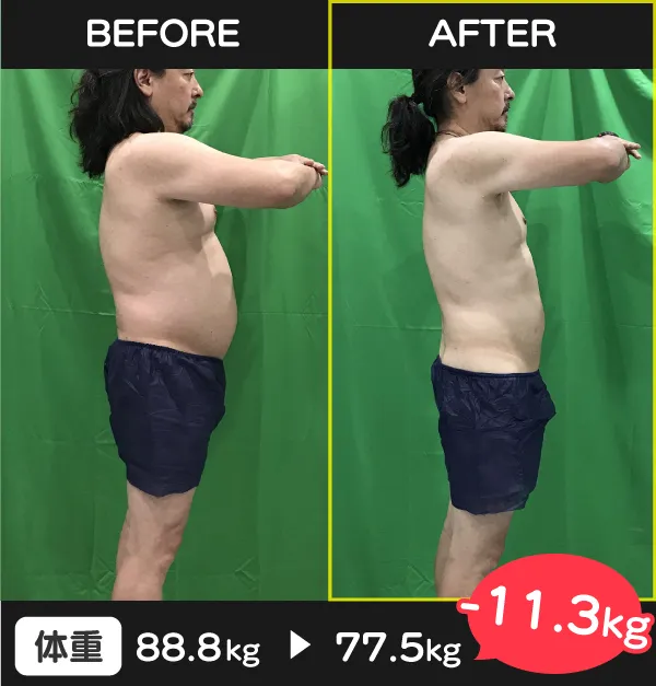 痩せる クリニック/お腹 脂肪 冷却 効果/医療 ダイエット